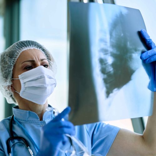 Dia Mundial de Combate à Tuberculose reforça importância do diagnóstico precoce e da adesão ao tratamento